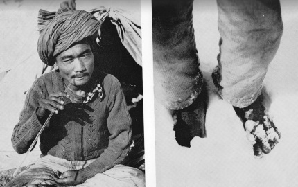 The Silver Hut pilgrim: eating a pipette (left), and showing his bare feet.